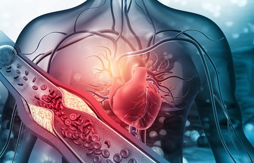 Read more about the article Vitamin E & Antioxidant for cholesterol